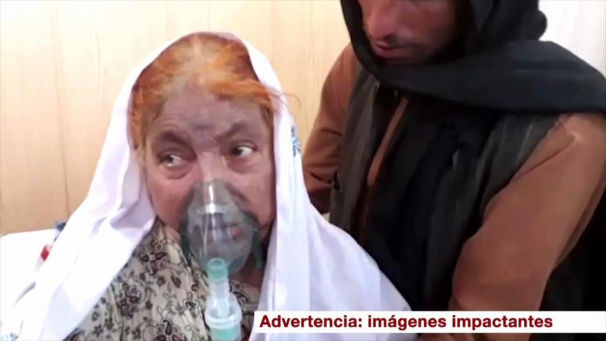 Ataque en Afganistán. Alimentación en Argentina. Agresión a HispanTV