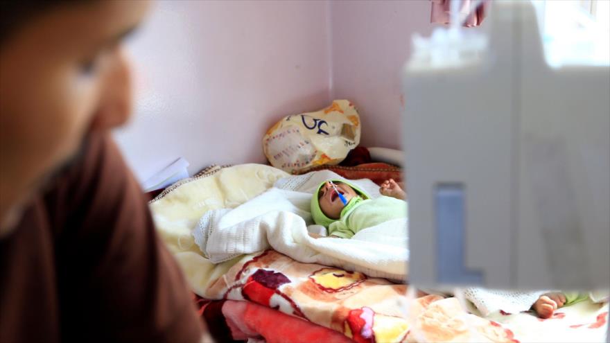 Un bebé yemení que sufre de malnutrición en un centro de atención médica en Saná, capital de Yemen, 5 de octubre de 2019. (Foto: AFP)