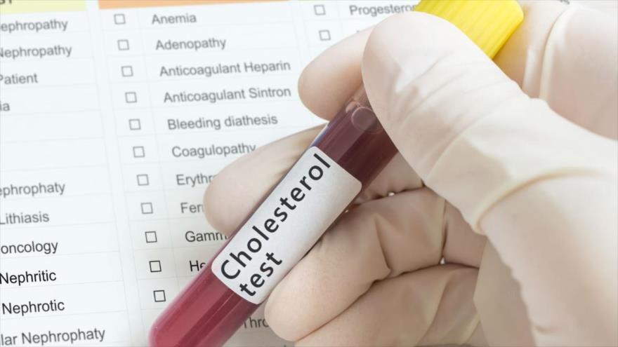 95 % de latinoamericanos desconoce si padece el colesterol alto.