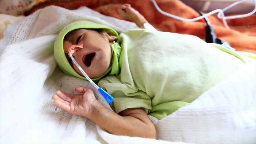 Bloqueo saudí a Yemen causó la muerte de más de 43 000 pacientes | HISPANTV