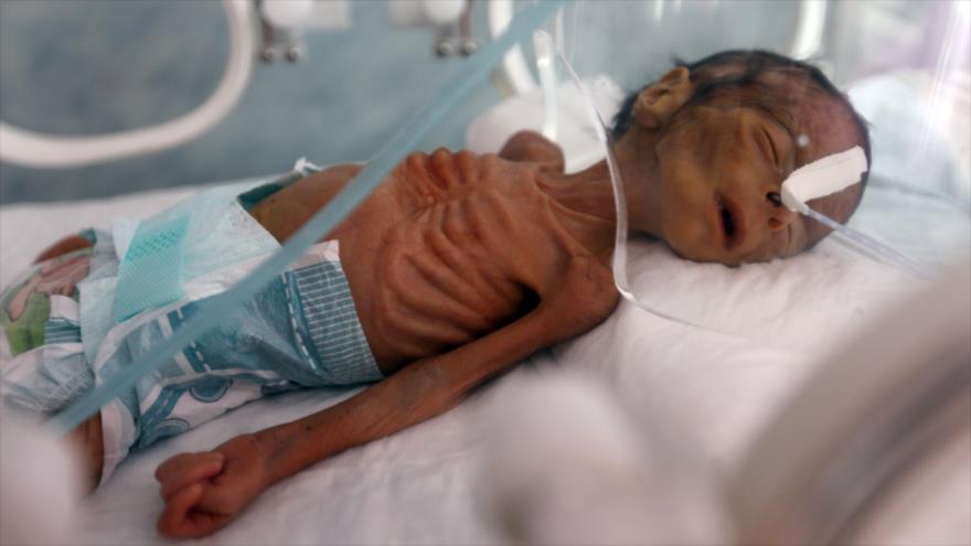 Un bebé recién nacido yemení en una incubadora en el hospital Al-Sabeen, Saná, capital yemení, 23 de noviembre de 2019. (Foto: AFP)