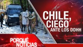 El Porqué de las Noticias: Día de la Ira palestina. Crisis en Colombia. Chile entre protestas y represión