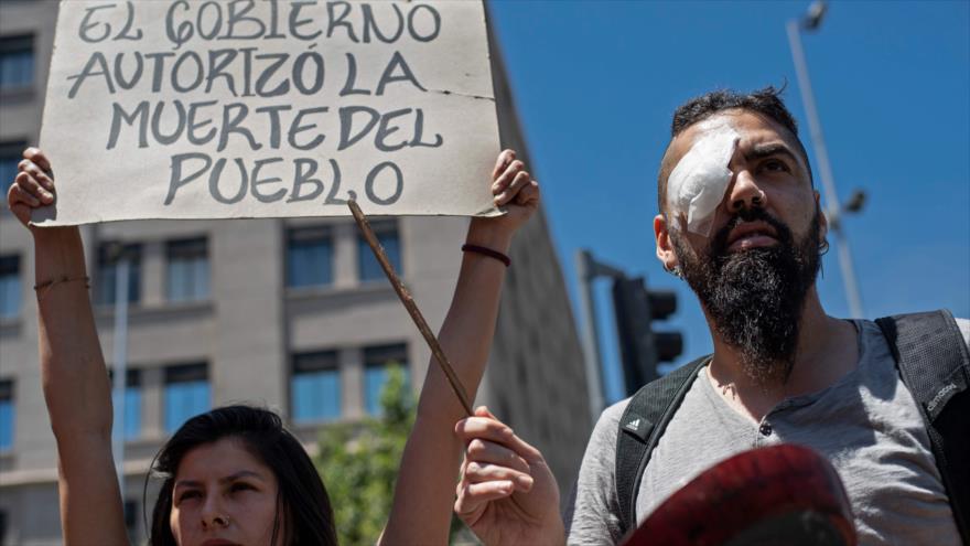 Vídeo: Heridos oculares protestan por violencia de Policía chilena | HISPANTV