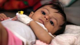 Bloqueo saudí aumenta muerte de niños yemeníes con cáncer