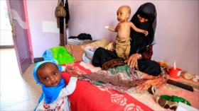 Guerra saudí provoca desórdenes mentales en 80 000 niños yemeníes