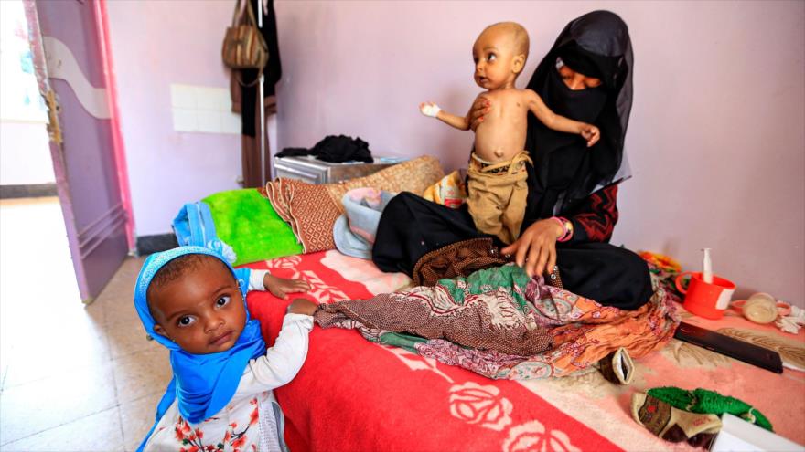 Una mujer yemení sostiene a un niño que sufre desnutrición en un hospital en Saná, capital de Yemen, 22 de junio de 2019. (Foto: AFP)