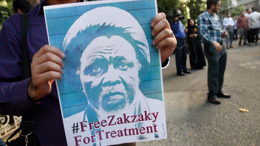 Informe: Hay 43 esquirlas de balas en cuerpo de sheij Al-Zakzaky | HISPANTV