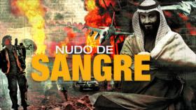 Detrás de la Razón: Yemen toma delantera sobre Arabia Saudí, la ONU alerta