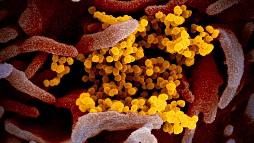 Revelan fotos en color que ilustran cómo es el nuevo coronavirus | HISPANTV