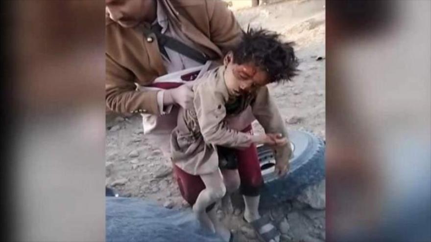 Unicef: 19 niños murieron en reciente ataque saudí en Yemen | HISPANTV