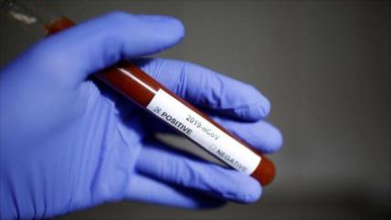 Nuevo avance: Vacuna contra coronavirus estará disponible en abril