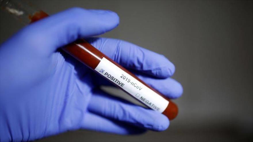 Nuevo avance: Vacuna contra coronavirus estará disponible en abril | HISPANTV