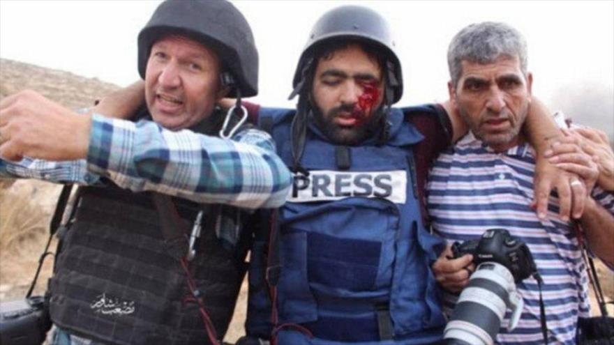 Un periodista resulta herido en un ojo por los disparos de soldados israelíes