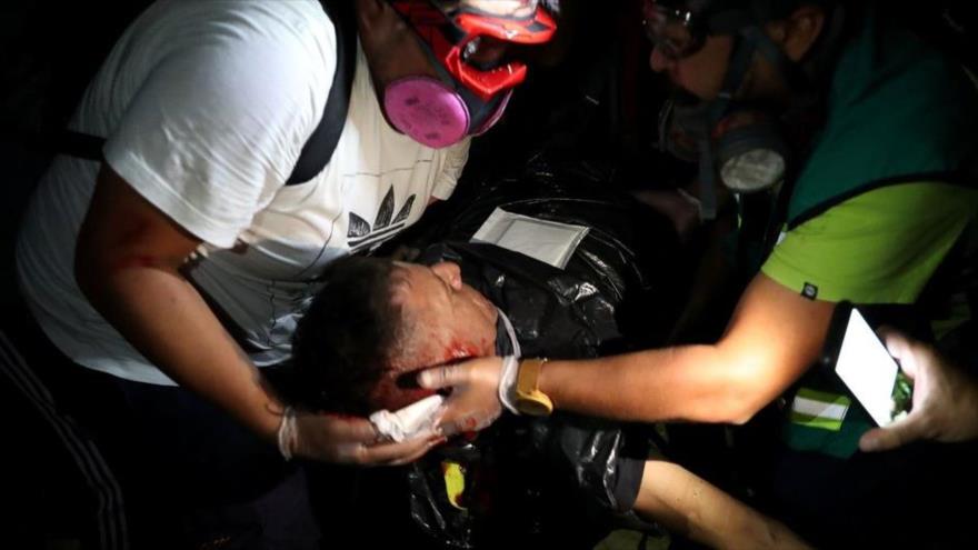 Vídeo: Muere manifestante chileno por impacto de bomba lacrimógena