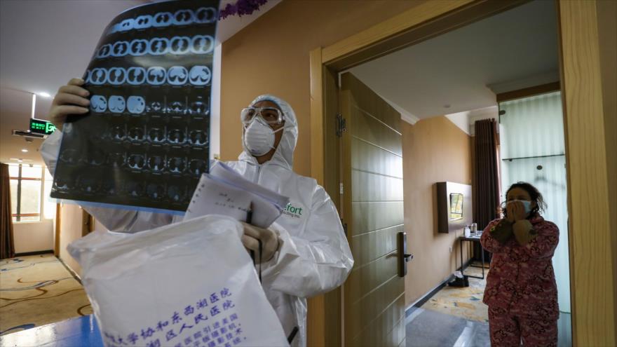 Un médico revisa radiografía de los pulmones de un afectado por el coronavirus en el hospital de Wuhan, China, 30 de enero de 2020. (Foto: AFP)