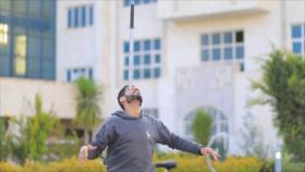 El Toque: 1- Rana de cristal 2- Construye sus propias prótesis 3- Yemení equilibrista 4- Palacio de Golestán en Teherán