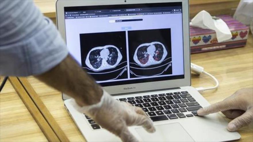 Una foto de tecnología inteligente de diagnóstico del COVID-19, 4 de abril de 2020. (Foto: Fars News)
