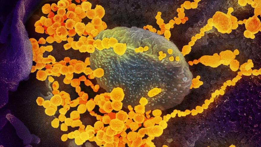 Imagen de microscopio electrónico que muestra al SARS-CoV-2 (objetos en amarillo), el virus que causa el brote del coronavirus. (Foto: NIAID-RML)