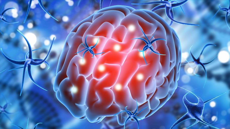 Médicos advierten que el coronavirus podría afectar al cerebro | HISPANTV