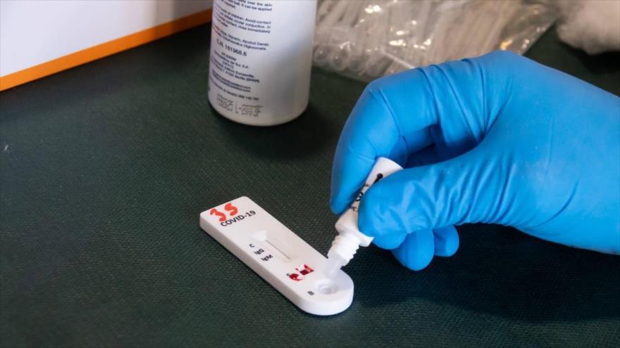 Una prueba de anticuerpos de detección del coronavirus, causante de la COVID-19. 