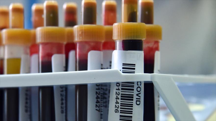 Muestras de sangre para detectar anticuerpos de la COVID-19 en una clínica en Moscú, capital rusa, 15 de mayo de 2020. (Foto: AFP)