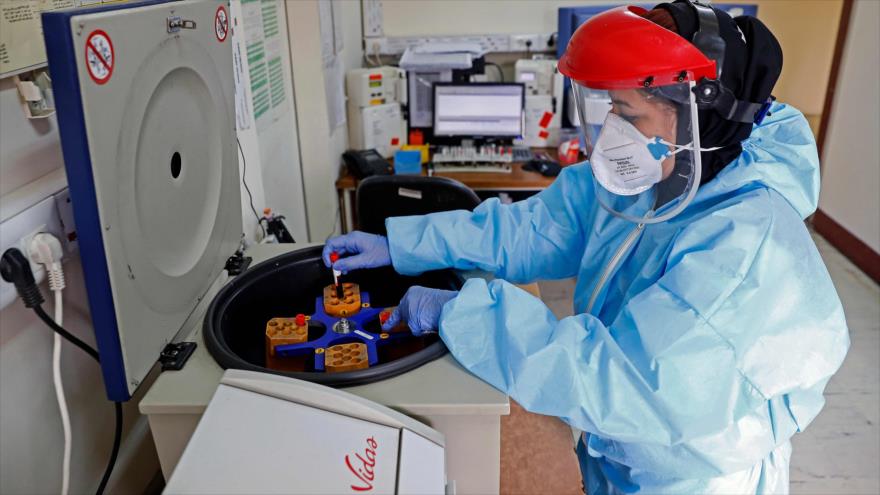 Una enfermera analiza un test del nuevo coronavirus en una hospital en Teherán, la capital del país, 1 de marzo de 2020. (Foto: AFP)