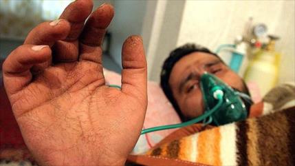 Irán: Sanciones de EEUU privan a víctimas de guerra de medicinas