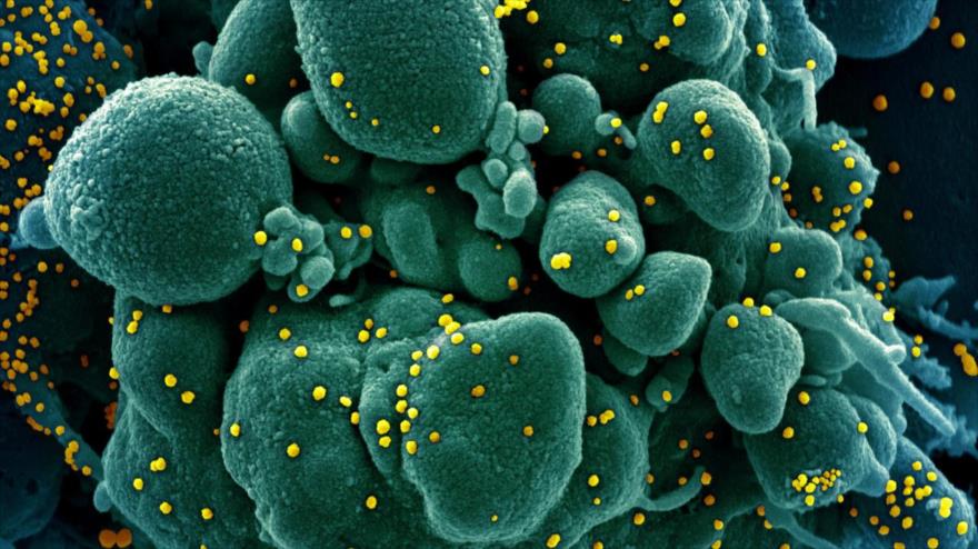 Una imagen de microscopio que muestra una célula contaminada con el coronavirus. (Foto: Reuters)