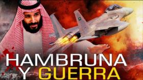 Detrás de la Razón: Programa Mundial de Alimentos urge recursos para evitar hambruna en Yemen