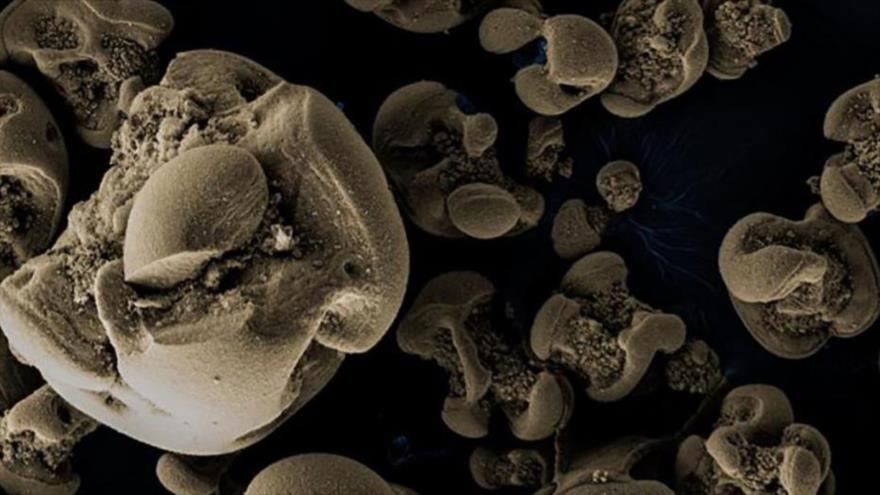 Investigadores descubren por accidente una rara bacteria que come metale.