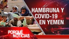 El Porqué de las Noticias: Yemen: Hambruna y COVID-19. Crisis del régimen israelí. Polémica gestión de Bolsonaro