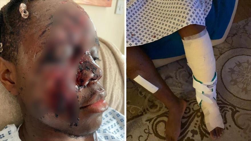Un joven negro de 21 años fue atropellado por un coche en un ataque racista en el Reino Unido, 29 de julio de 2020.