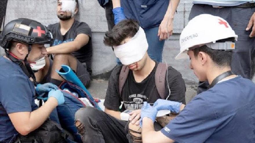 Fiscalía de Chile acusa a un policía de dejar ciego a un manifestante | HISPANTV