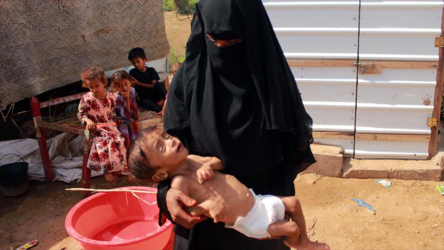 Un niño yemení desplazado que sufre de desnutrición con su madre en un campamento en Hajjah (noroeste), 3 de septiembre de 2020. (Foto: AFP)