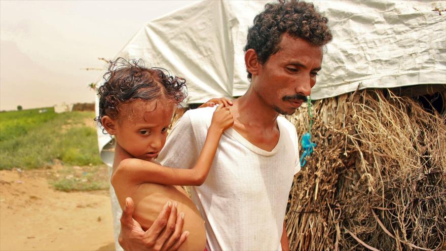Un hombre desplazado junto con su hija que sufre de desnutrición en la gobernación de Hajjah, noroeste de Yemen, 23 de septiembre de 2020. (Foto: AFP)