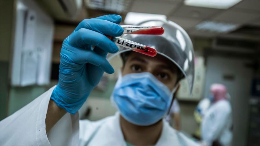 Un trabajador médico egipcio revisa la sangre donada por una persona que se recuperó de la COVID-19 en El Cairo. 22 de julio de 2020. (Foto: AFP)