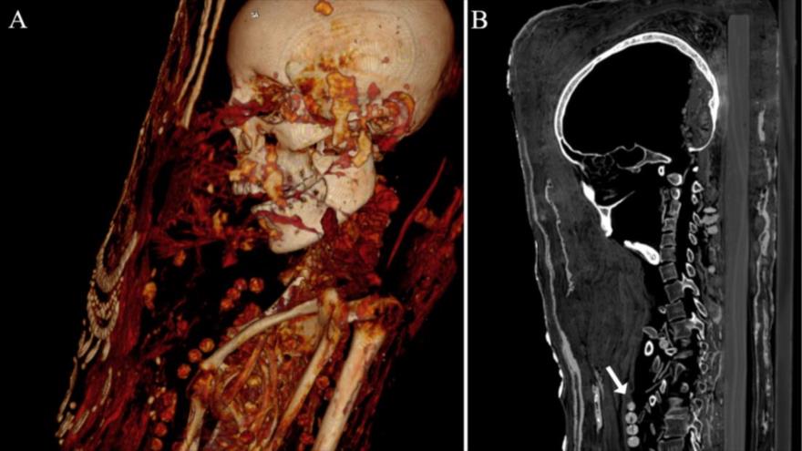 Hallan momia con algunos órganos conservados en Egipto | HISPANTV