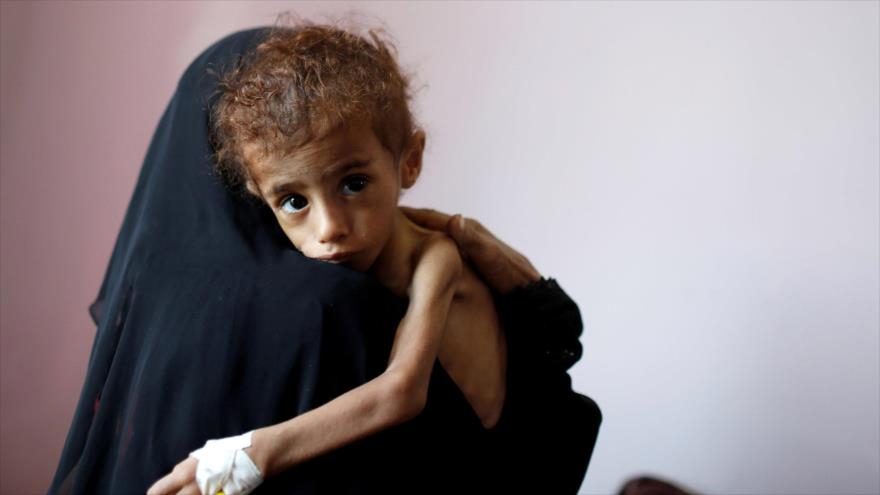 Diplomático iraní: agresión a Yemen no tendrá ningún resultado | HISPANTV