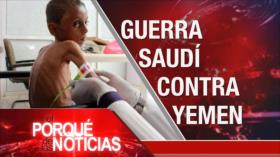 El Porqué de las Noticias: No al expansionismo israelí. Hambruna en Yemen. Crisis política en Perú 