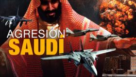 Detrás de la Razón: Guterres asegura que Yemen se podría convertir en el peor desastre humanitario