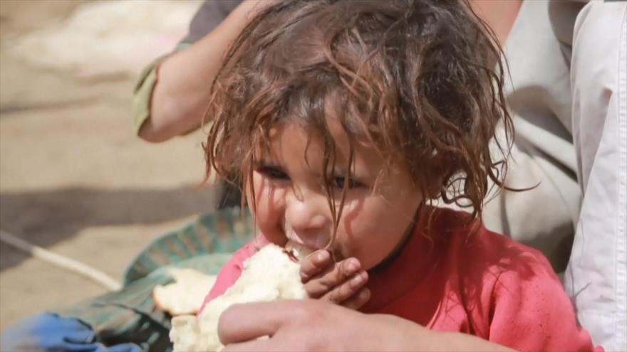 Malnutrición de niños yemeníes, una secuela de la agresión saudí | HISPANTV