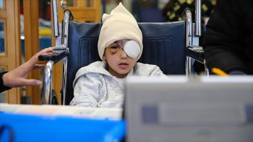 Malek Isa, niño palestino que perdió un ojo por el disparo de una bala con punta de esponja durante una represión de las fuerzas israelíes en Al-Quds.