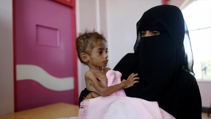 ONU: Mitad de los yemeníes sufre inseguridad alimentaria aguda