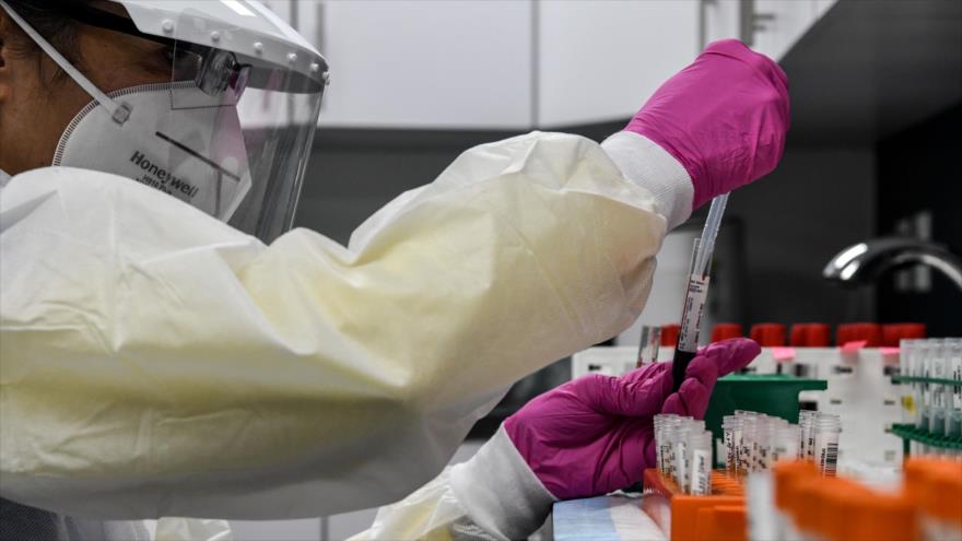 Un experto clasifica muestras de sangre para la prueba de la COVID-19 en un laboratorio en Florida, 13 de agosto de 2020. (Foto: AFP)