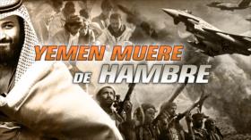 Detrás de la Razón: La ONU pide actuar antes de que Yemen se dirija a la hambruna