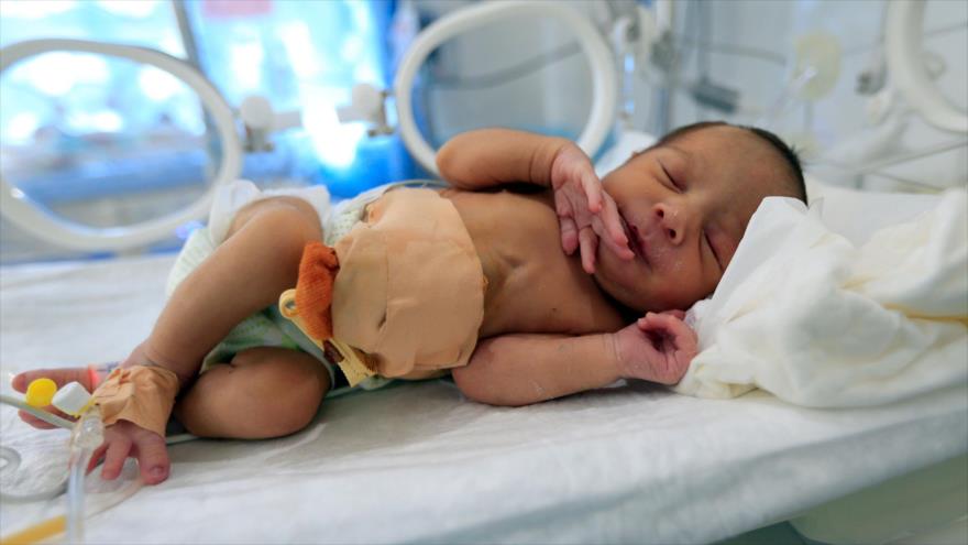 Mueren cada año 100 000 recién nacidos en Yemen por bloqueo saudí | HISPANTV