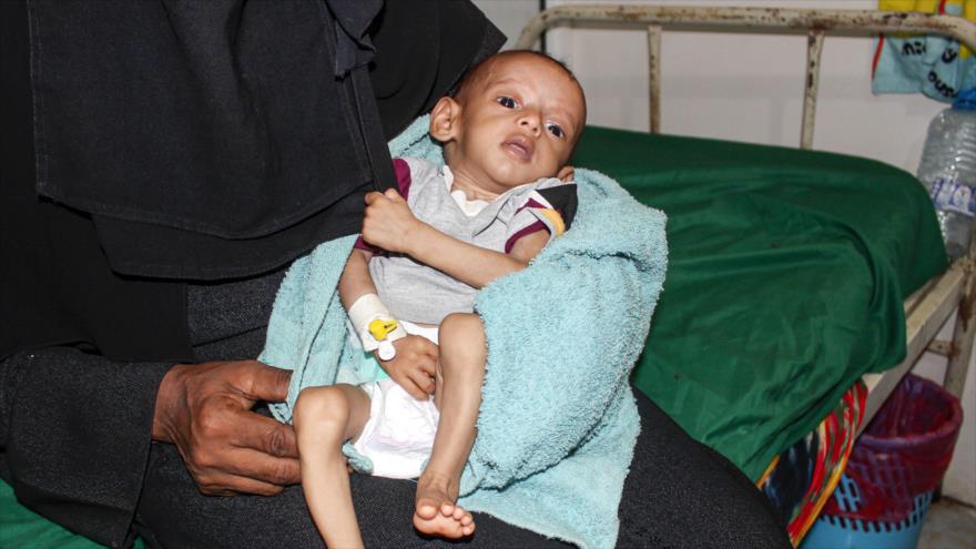 Impactante cifra: 4000 niños yemeníes muertos en ataques saudíes | HISPANTV