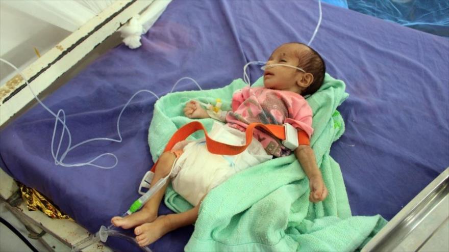 Un bebé recibe tratamiento en un centro de tratamiento de desnutrición en la provincia de Hajjah, norte de Yemen, 22 de noviembre de 2020. (Foto: AFP)
