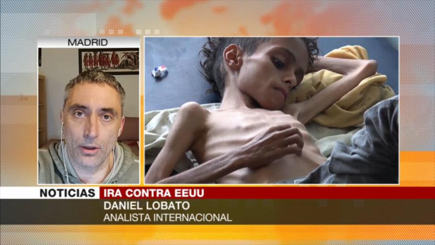 Lobato: EEUU es el “cerebro de la catástrofe” que vive Yemen