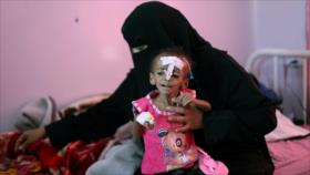 Yemen pide a ONU atender catástrofe que vive por agresión saudí